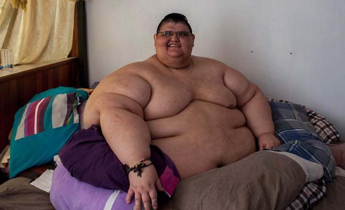 Juan Pedro Franco (33), asal Meksiko  saat memiliki berat hampir 600 kg. (foto:afp) 