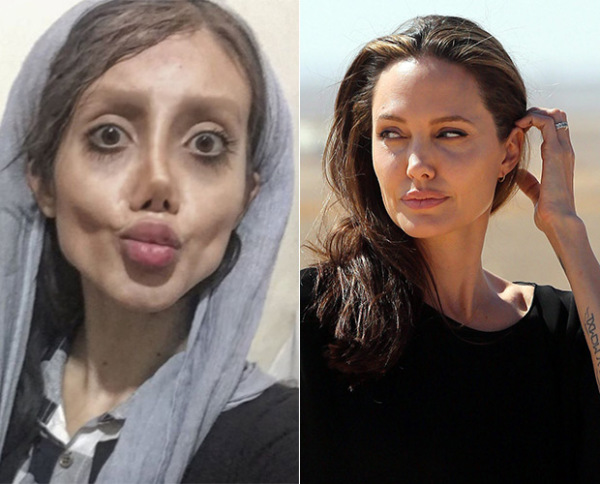 Berobsesi ingin mirip Angelina Jolie, gadis Iran bernama Sahar Tabar ini rela operasi berkali-kali. (Foto: Google)