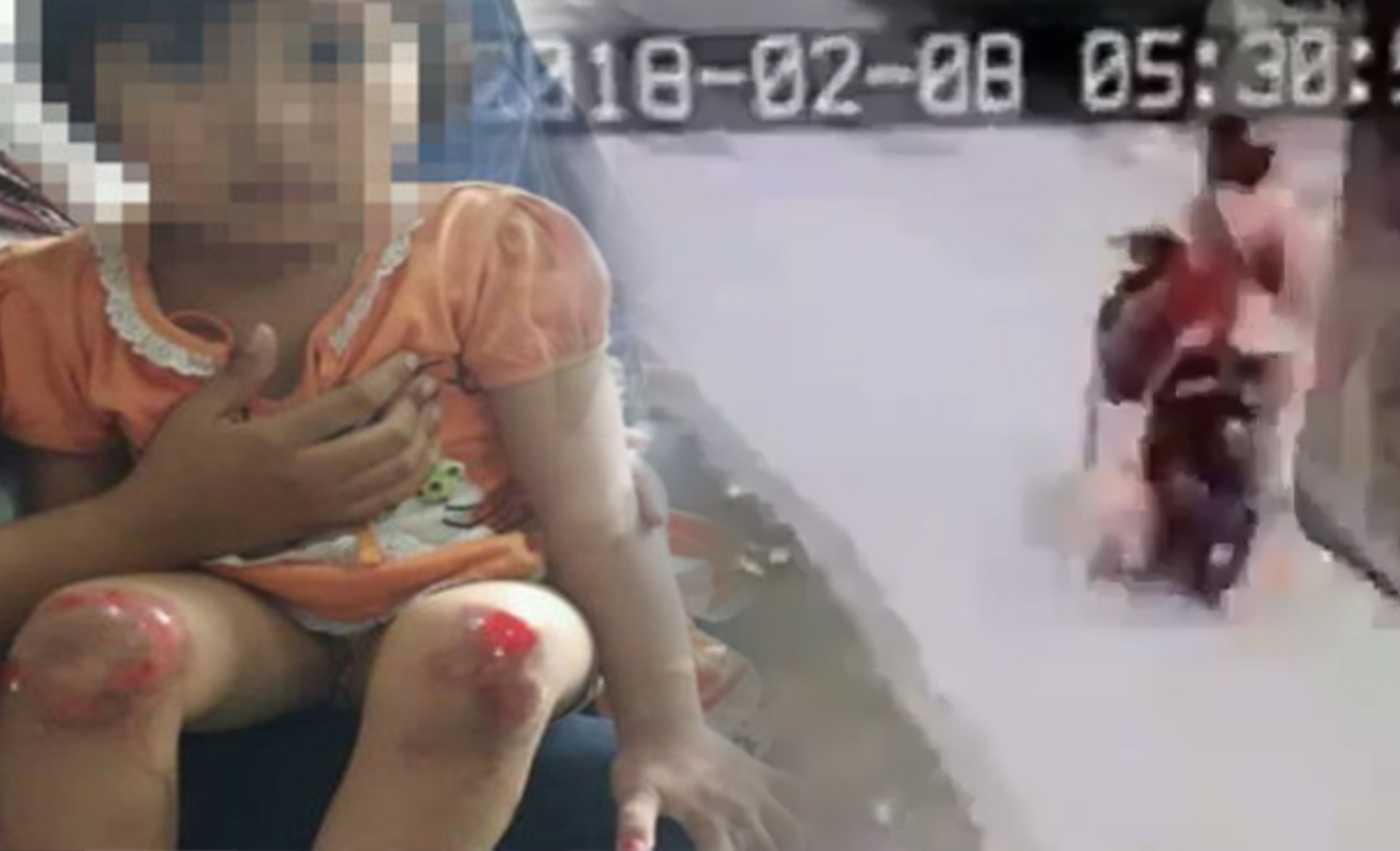 Tangakapan layar dari cuplikan CCTV yang terlihat sang ibu tengah menyeret anaknya dengan motor (kanan) dan foto kondisi sang anak setelah kejadian penyeretan dengan motor tersebut (kiri)  (foto: instagram)