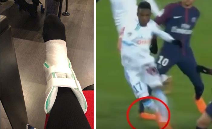 Kaki kanan Neymar usai dioperasi (kiri), dan posisi kaki kanan Neymar yang memutar saat laga melawan Marseille  hari Minggu 25 Februari lalu. (foto: dokumentasi)