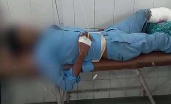  Ghanshyam, pasien yang ditidurkan berbantal potongan kakinya, di rumah sakit Maharani Hospital di  Jhansi,  wilayah Uttar Pradesh, India. (foto: afp)