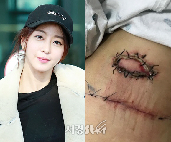 Han Ye Seul mempunyai bekas luka usai operasi lipoma di bagian ketiak.