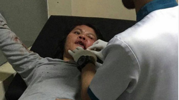 Iptu Polwan Sulastri mendapat perawatan medis di Rumah Sakit Bhayangkara TK I Raden Said Sukanto, Kramat Jati, Jakarta Timur.