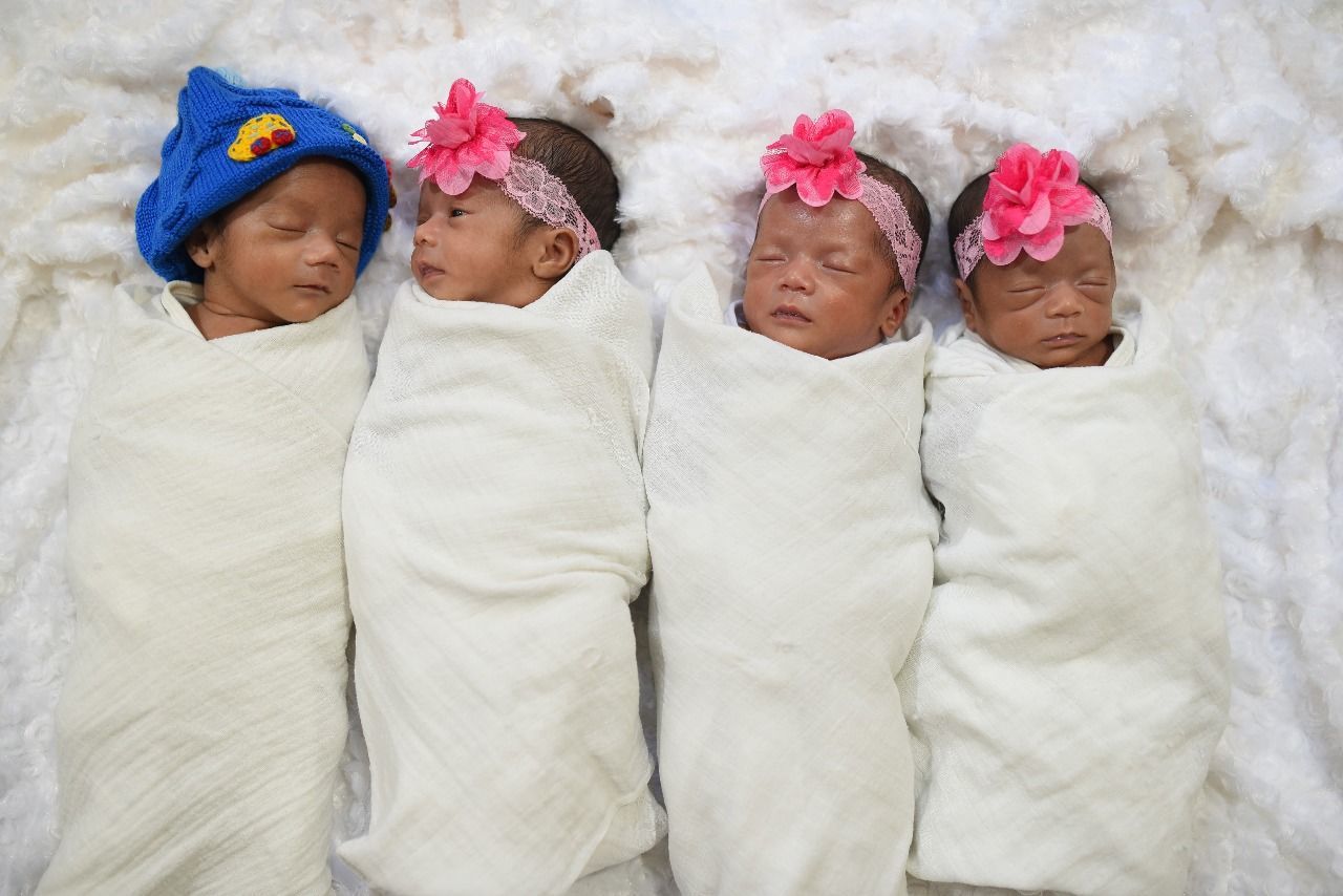 Satu bayi berjenis kelamin laki-laki dn 3 perempuan ini lahir dari program bayi tabung pasangan Luh Gede Irin Pradnyawati dan Putu Agra Ricna Sukarmawan.
