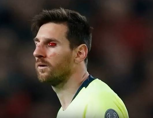 Lionel Messi, mengalami cedera saat bertandang ke markas Manchester United (MU)