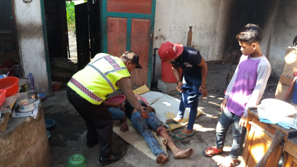 Dwi Mutiara, korban ledakan mercon di Desa Sukorejo Kecamatan Kepung, Kediri. (Foto: Istimewa)