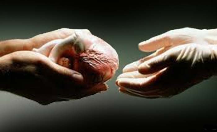 Ilustrasi donor organ tubuh. (Ngobar)