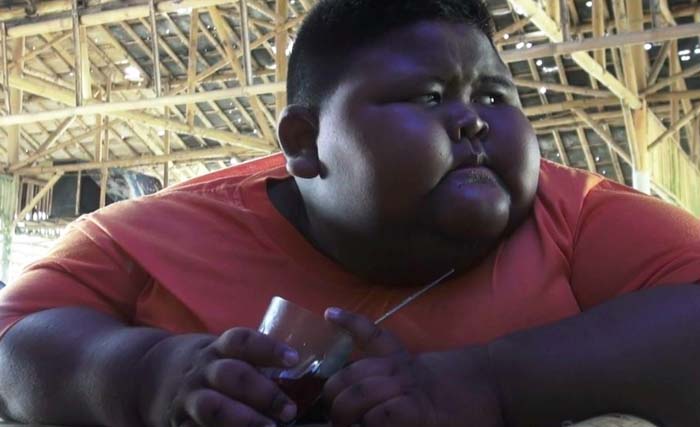 Satya Putra, 7 tahun, mengalami obesitas ekstrem. (Foto:Net.Id)