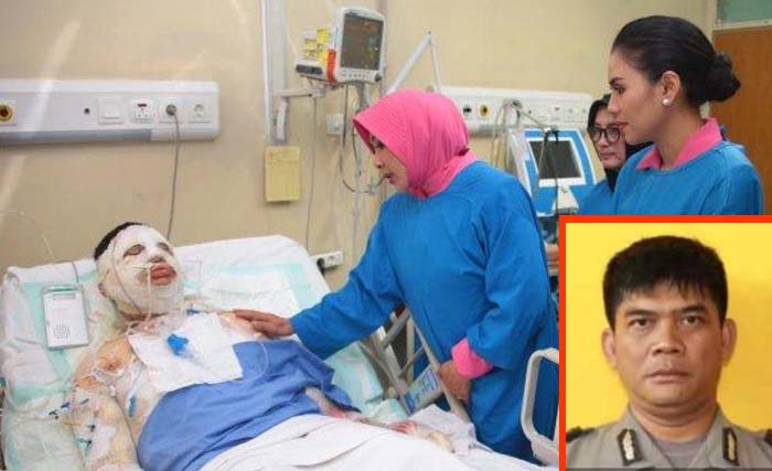 Ipda Erwin Yudha Wildan saat dirawat di RSP Pertamina Jakarta, Inzet Ipda Erwin Yudha Wildan. (Foto:Antara)