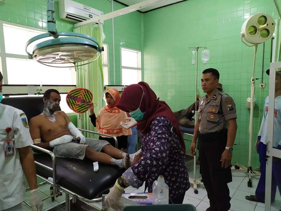 Salah satu korban letusan balon, dirawat di RSUD Pare Kabupaten Kediri (Foto: Istimewa)