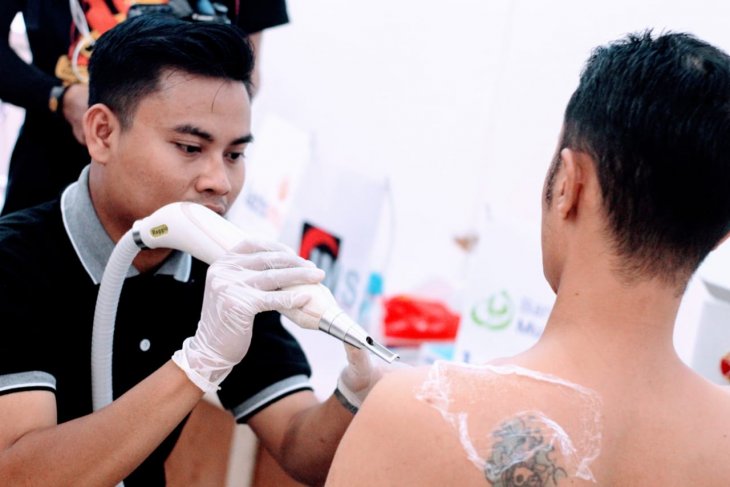 Sekitar dua ribu warga di Nusa Tenggara Barat akan menghapus tato yang berlangsung selama 15 hari dari 26 Oktober sampai 10 November 2019. (Foto: dok/antara)