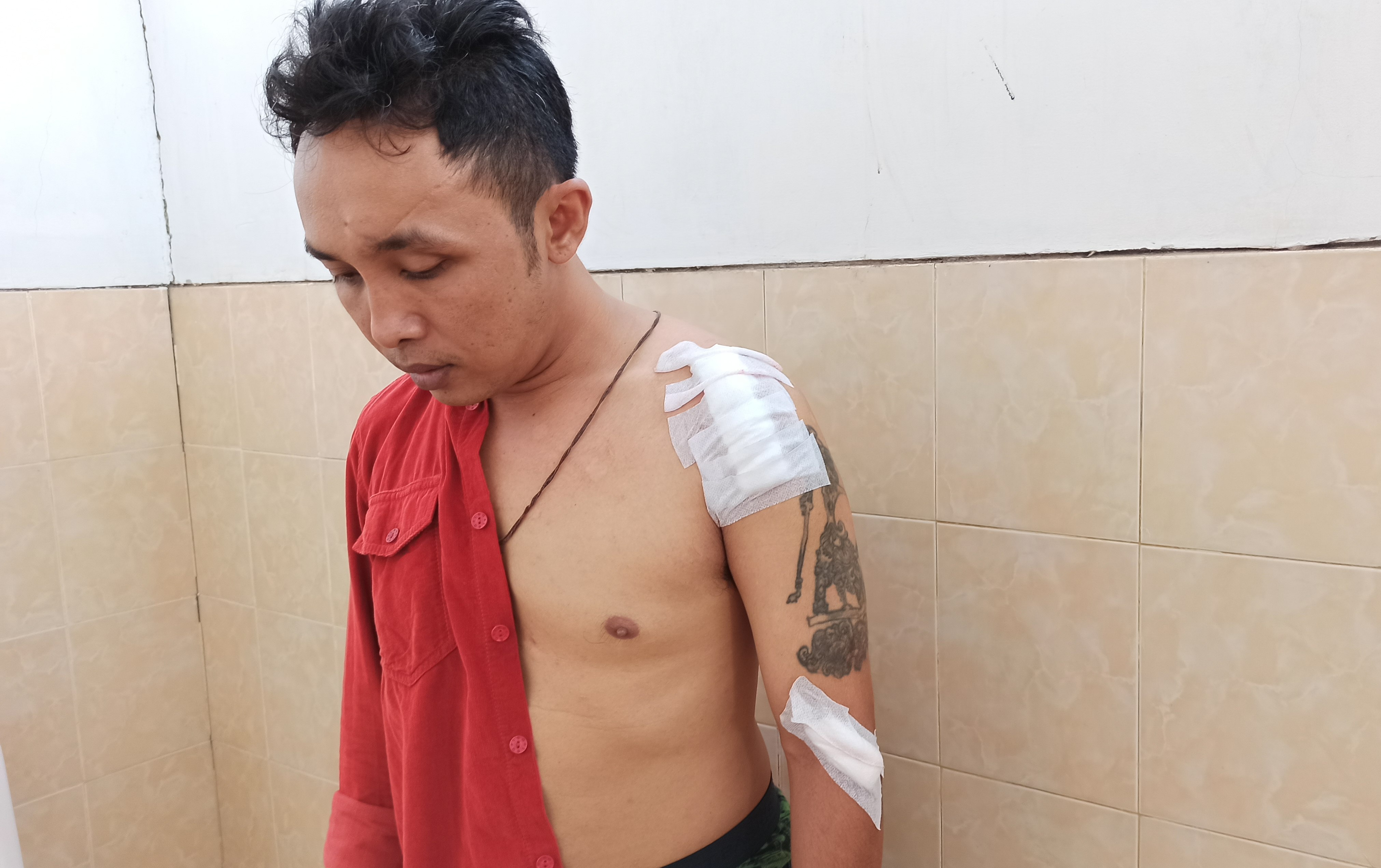 Mantan calon kepala Desa Kemiren, Slamet Kurniawan, menunjukkan luka yang dialaminya pasca penusukan. (Foto: Muh Hujaini/ngopibareng.id)