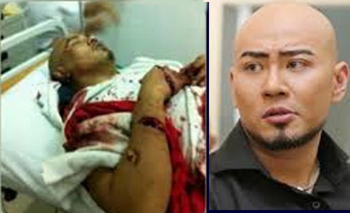 Foto pria terbaring luka parah yang beredar, dan kanan foto Deddy Corbuzier. (NGobar)