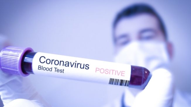 Ilustrasi Virus Corona. (Foto: Istimewa)