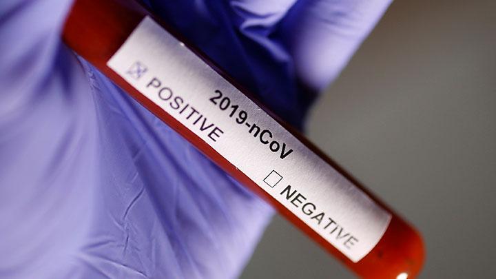 Sampel darah yang terinfeksi virus 2019-nCov. (Foto: Ilustrasi)