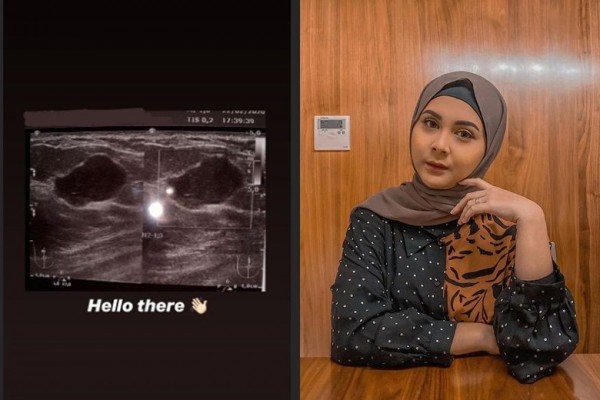 Artis Kesha Ratuliu memperlihatkan hasil USG tumor payudaranya. (Foto: Instagram)