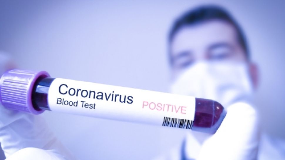 Ilustrasi virus corona. (Foto: Google)
