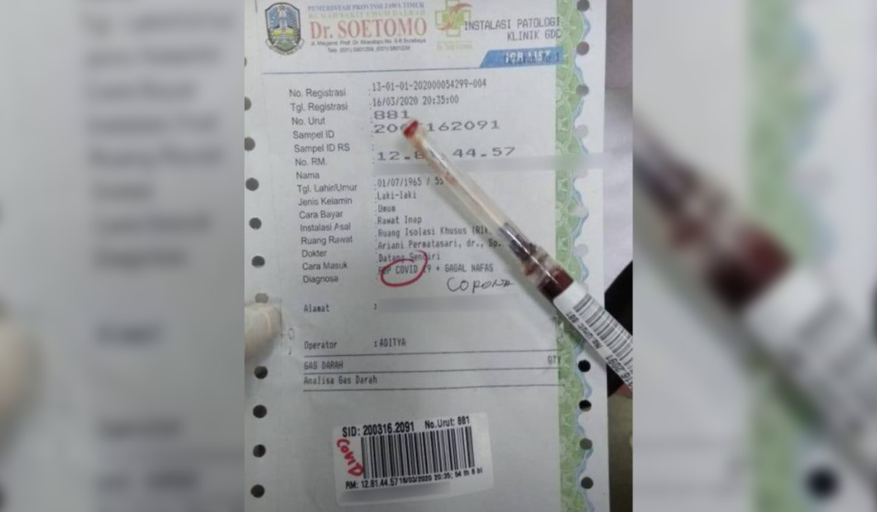 Hasil diagnosa salah satu pasien suspect corona di RSUD Dr Soetomo. (Foto: Alief/Ngopibareng.id)