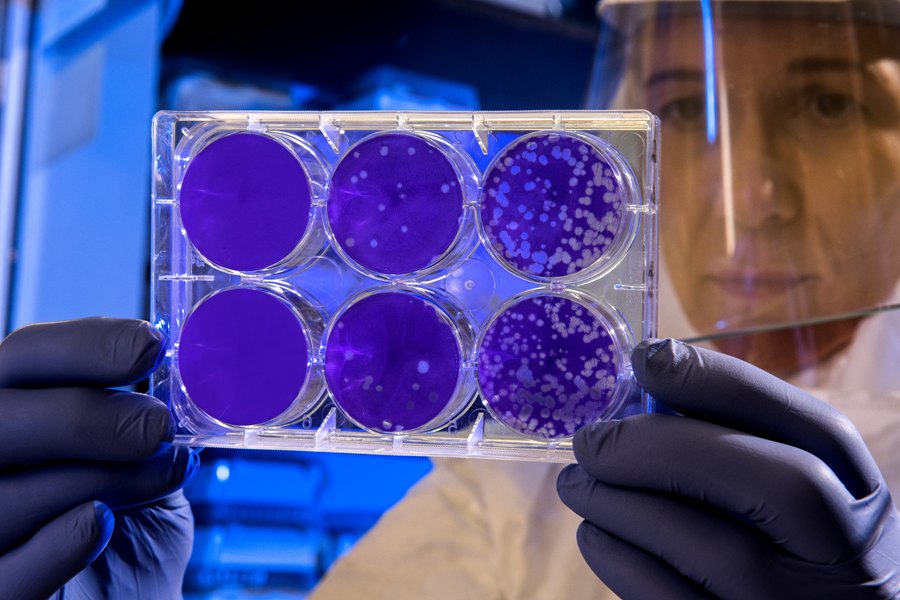 Peneliti di Australia menemukan obat yang mampu membunuh virus covid-19. (Foto: Unsplash.com)