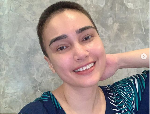 Feby Febiola pamer foto rambut barunya dibotaki setelah rontok karena efek kemoterapi usai operasi kista ovarium. (Foto: Instagram Feby Febiola)