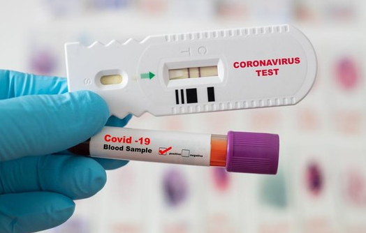 Ilustrasi rapid test antigen telah ditetapkan batas harga maksimal oleh Kementerian Kesehatan (Kemenkes) RI. (Foto: Istimewa)