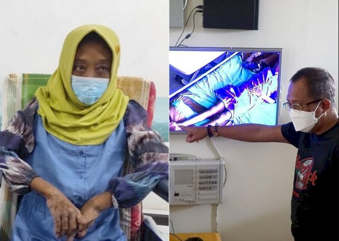 Asisten rumah tangga (ART) Elok Anggraini Setyawati korban penganiayaan majikan di Manyar, Surabaya (kiri). Dia sempat dikunjungi Wakil Walikota Surabaya saat ART dirawat di RS Bhayangkara Surabaya. (Foto: Istimewa)