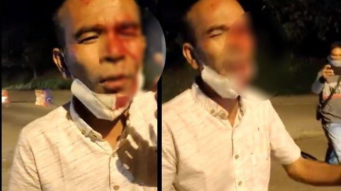 Awalludin Rao mengaku matanya tertusuk pena saat diamankan petugas posko PPKM di Padang. (Foto: Tangkapan layar)