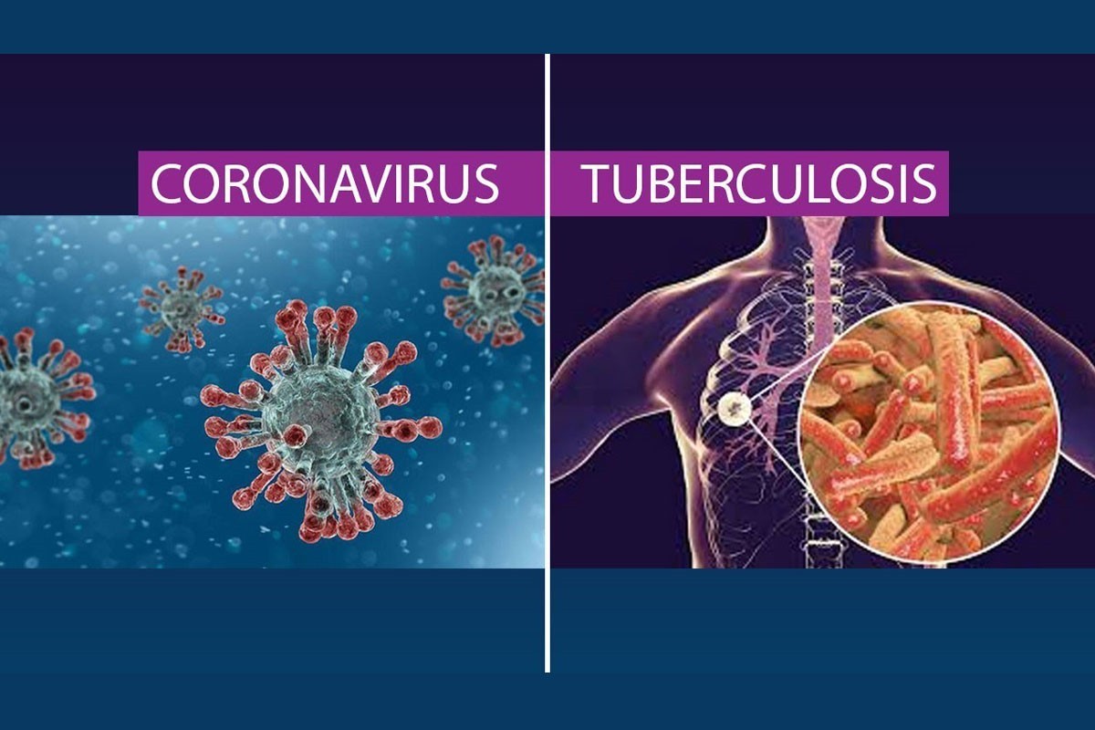 Ilustrasi dari organ paru-paru yang terinfeksi oleh virus covid-19 dan terkena bakteri (kuman) TBC. (Grafis: Istimewa)
