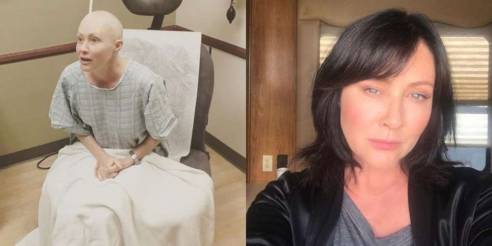 Shannen Doherty, salah satu bintang serial TV Amerika, Beverly Hills 90210, mengidap kanker payudara stadium 4 hingga mengalami kerontokan rambut efek kemoterapi. (Foto: Instagram)