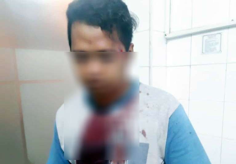 Anggota Satpol PP yang menjadi korban penganiayaan oleh oknum TNI.(Foto dok. Satpol PP Kota Mojokerto)
