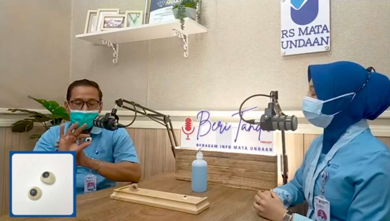 Kuncoro Djakti saat menunjukan jenis protesa mata ocular di podcast Beri Tanda RS Mata Undaan. (Foto: tangkapan layar)