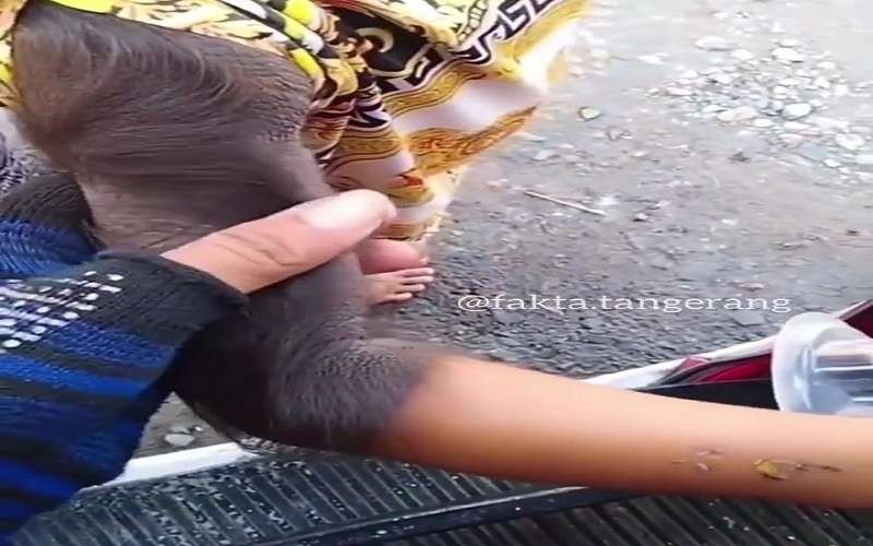 Lengan kanan seorang anak yang ditumbuhi rambut lebat. (Foto: Instagram @Fakta.indo)