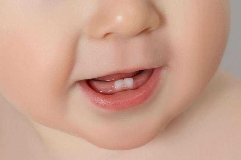 Ilustrasi natal teeth, fenomena bayi terlahir dengan gigi. (Foto: Istimewa)