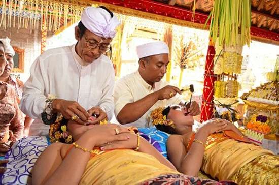 Ilustrasi tradisi potong gigi atau metatah adat Bali ketika akan beranjak dewasa. (Foto: Istimewa)