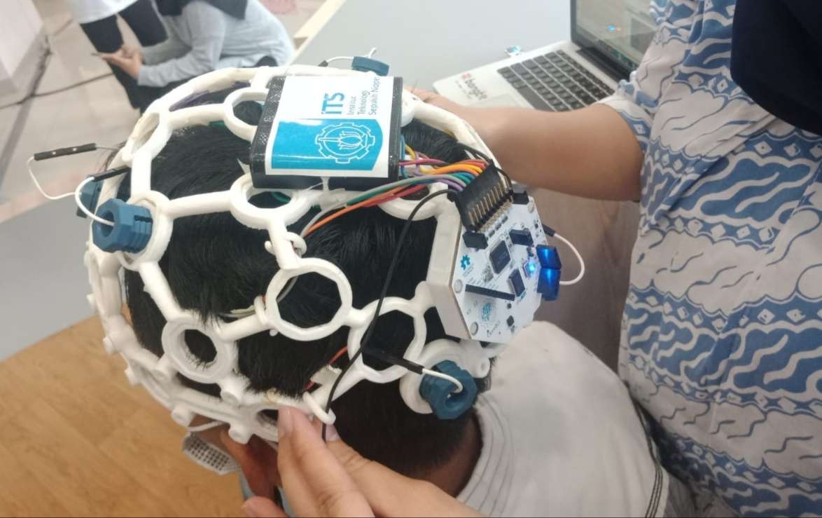 Alat Electro Encephalography (EEG) digunakan untuk memantau rehabilitasi pasien stroke. (Foto: Istimewa)