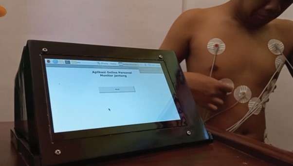 Pengunaan alat ECG jantung yang dikembangkan ITS berbasis internet. (Foto: istimewa)