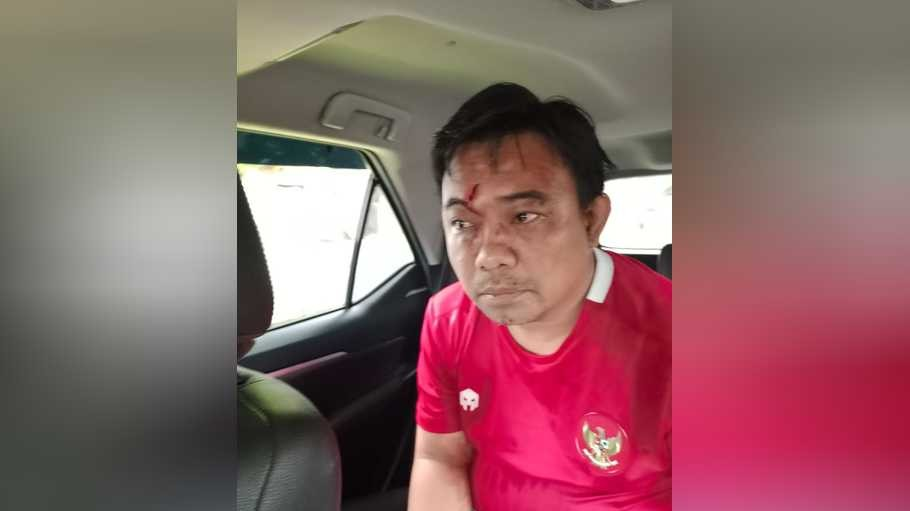 Ketua Umum DPP KNPI Haris Pertama diduga diserang oleh sekelompok orang tidak dikenal di kawasan Menteng, Jakarta Pusat. (Foto: Istimewa)