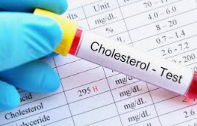 Bahaya kolesterol tinggi, salah satunya mati mendadak. (Foto: lifepack)