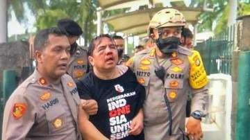 Ade Armando saat dievakuasi polisi usai menjadi korban amukan massa. (Foto: Istimewa)