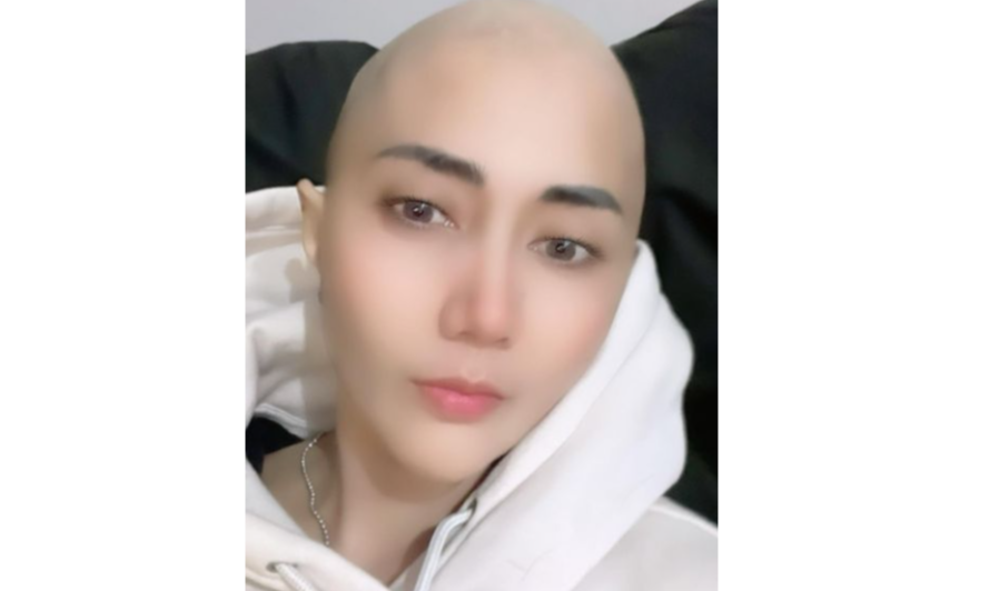 Pedangdut Aida Saskia membabat habis rambutnya karena rontok akibat kemoterapi. (Foto: Instagram)