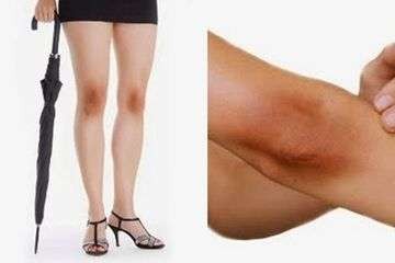 Ilustrasi cara mencerahkan siku dan lutut secara alami. (Foto: Istimewa)