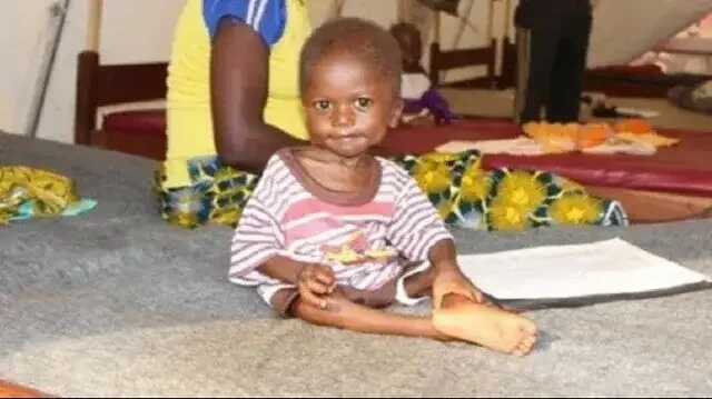 Kelaparan dan kemiskinan melanda Uganda. Inilah wajah anak dari Karamajo, Uganda (Foto: AFP)