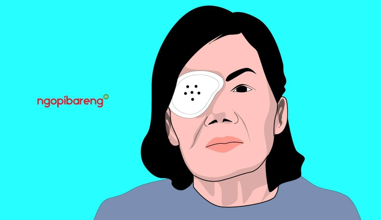 Ilustrasi seorang pasien pasca operasi mata. (Grafis: Fa Vidhi/Ngopibareng.id)