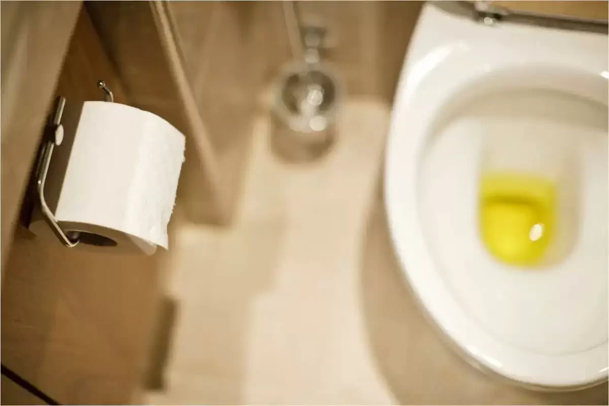 Ilustrasi warna urine dapat menunjukkan masalah kesehatan Anda. (Foto: Istimewa)