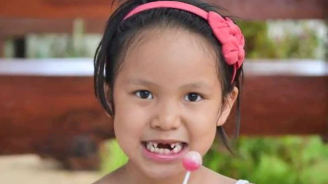 Ilustrasi makanan manis bisa memicu karies gigi pada anak-anak. (Foto: Istimewa)