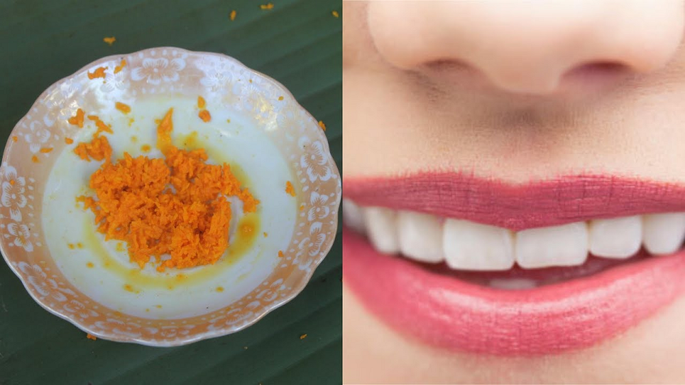 Ilustrasi cara mencerahkan bibir agar menjadi sehat dengan menggunakan bahan alami.(Foto: Istimewa)