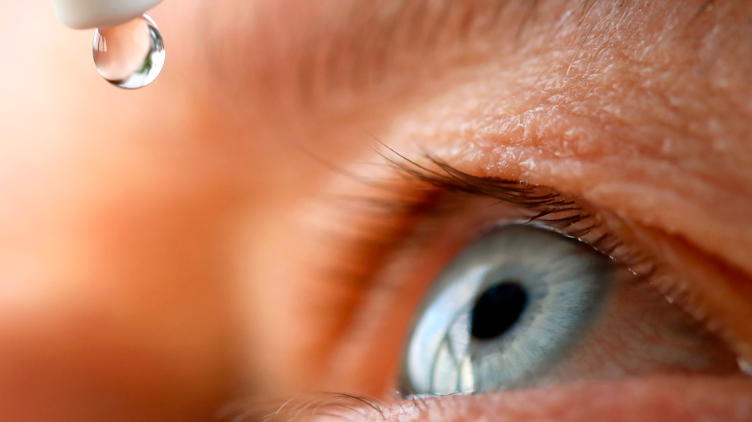 Ilustrasi dry eye syndrome atau sering disebut sindrom mata kering. Segera periksakan ke Rumah Sakit Mata Undaan. (Foto: https://www.barraquer.com)