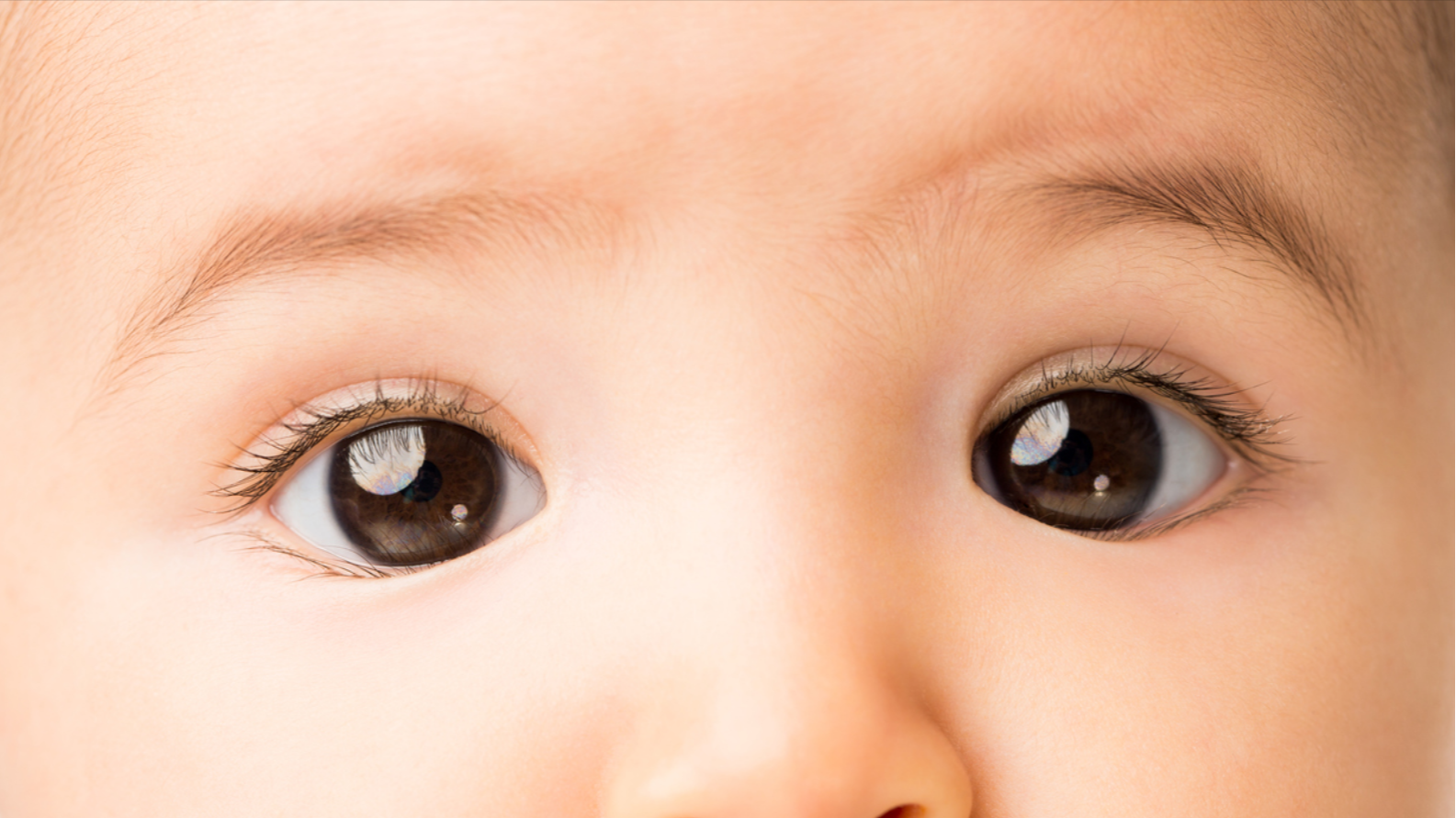 Ilustrasi mata juling pada bayi. Normalkah?