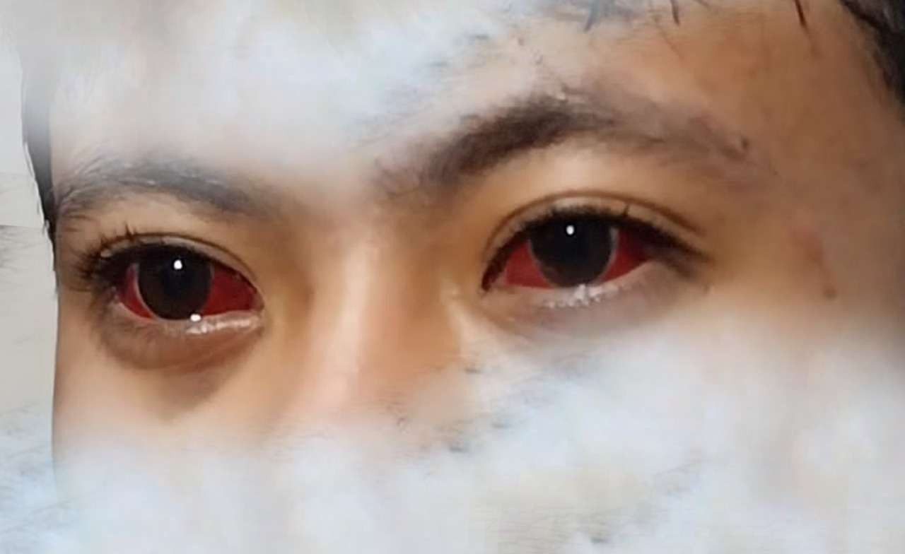 Ilustrasi mata merah karena tembakan gas air mata. (Foto: Fa Vidi/Ngopibareng.id)