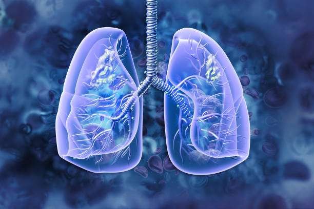 Ilustrasi paru-paru. Kasus pneumonia pada anak-anak di Surabaya kembali bertambah. (Foto: Pixabay)